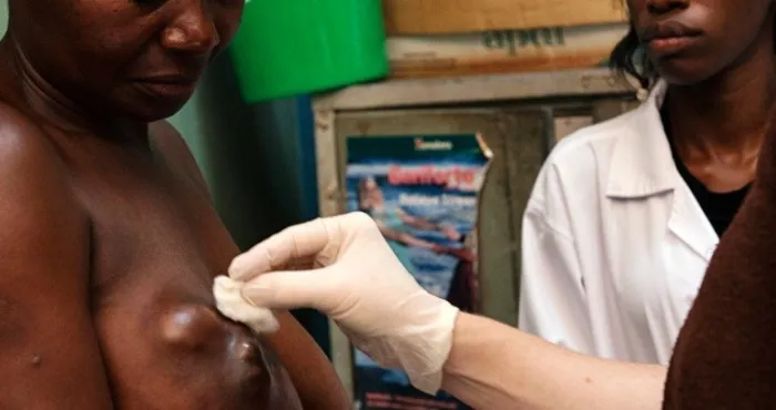 cancer-du-sein-tout-sur-les-symptomes-et-les-facteurs-de-risque